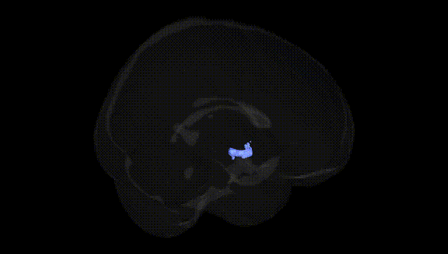 Full Brain Black