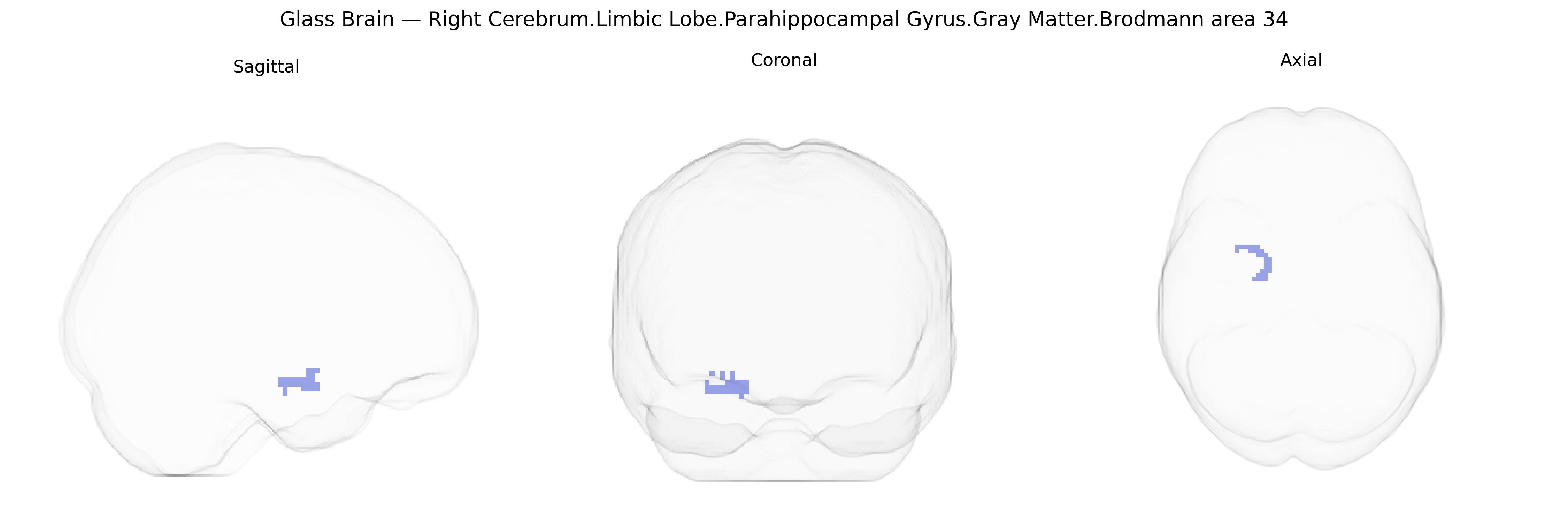 Triplanar Ghost Brain