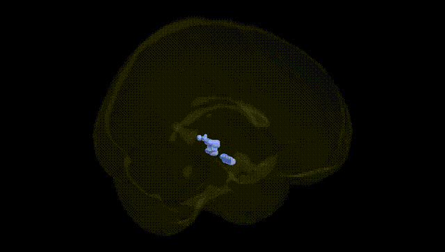 Full Brain Black