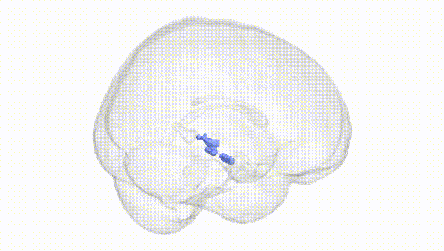 Full Brain White