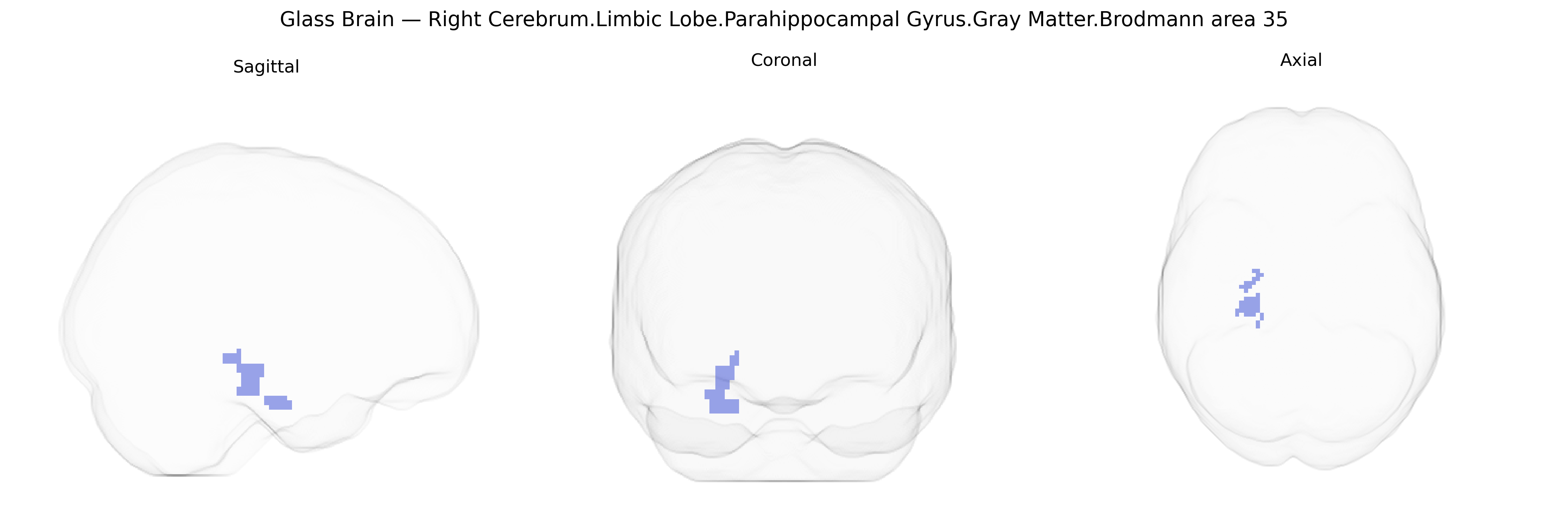 Triplanar Ghost Brain