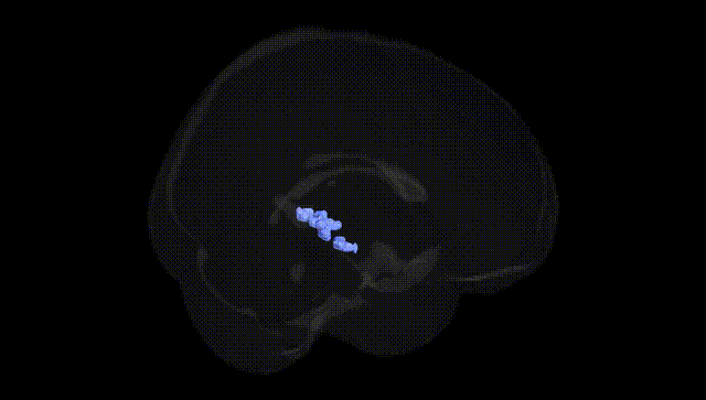 Full Brain Black