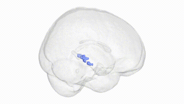 Full Brain White