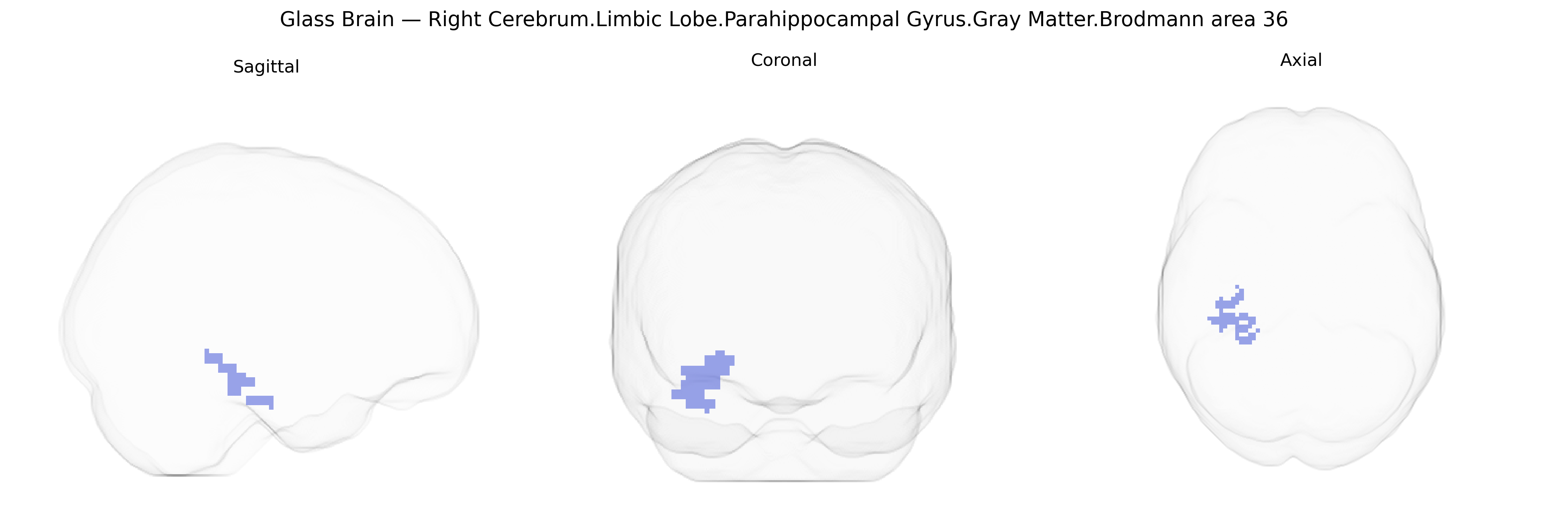 Triplanar Ghost Brain