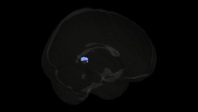 Full Brain Black