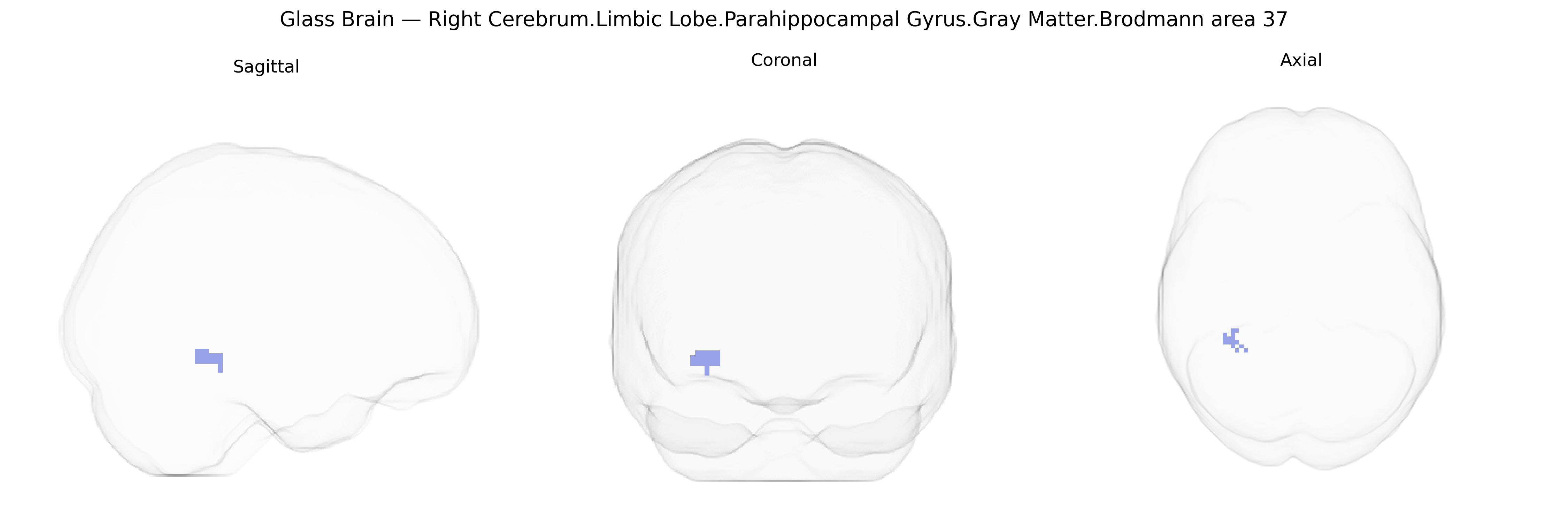 Triplanar Ghost Brain