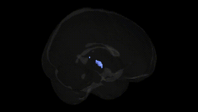Full Brain Black