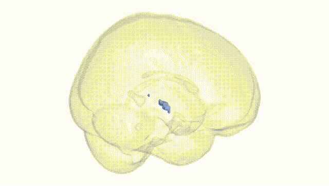 Full Brain White