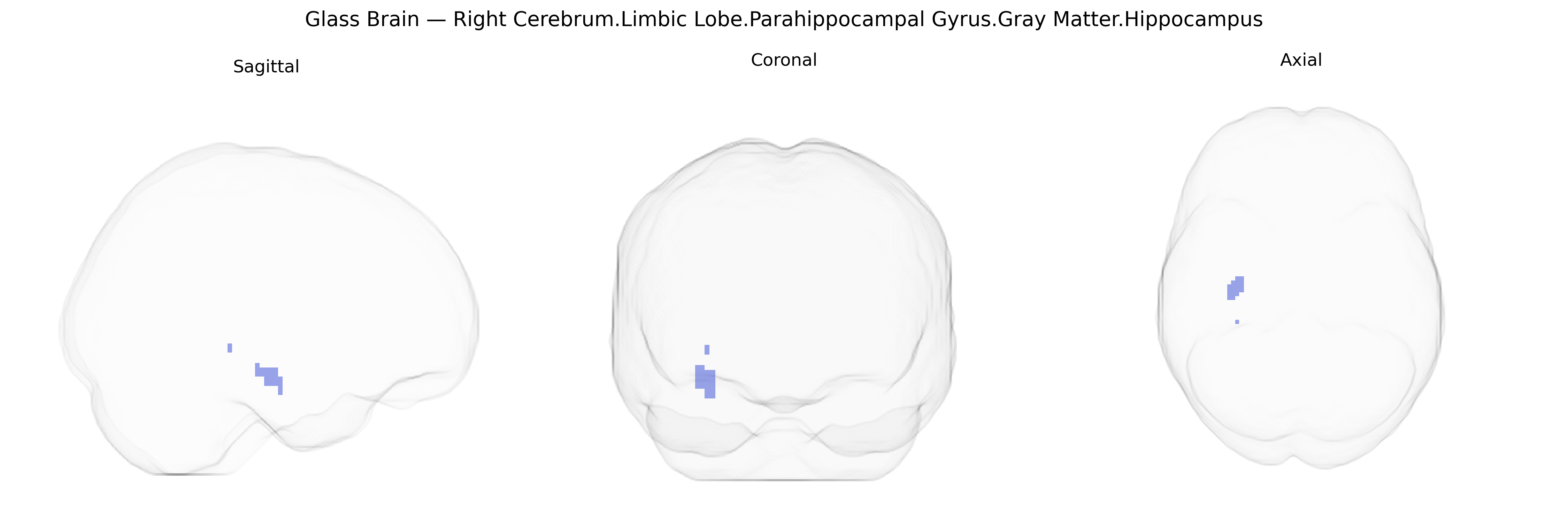 Triplanar Ghost Brain