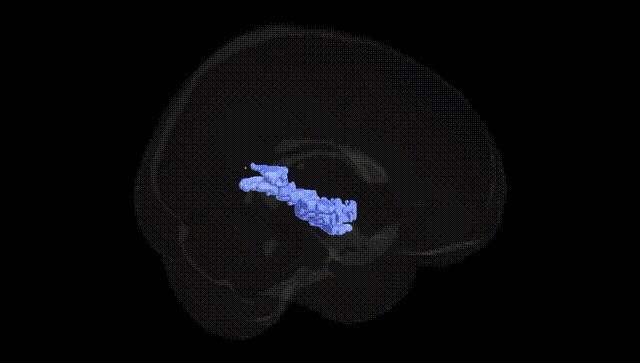 Full Brain Black