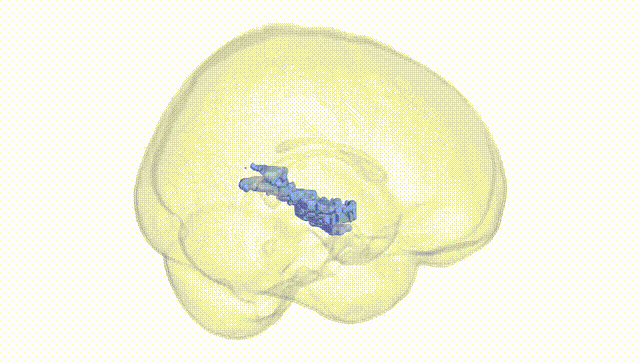 Full Brain White