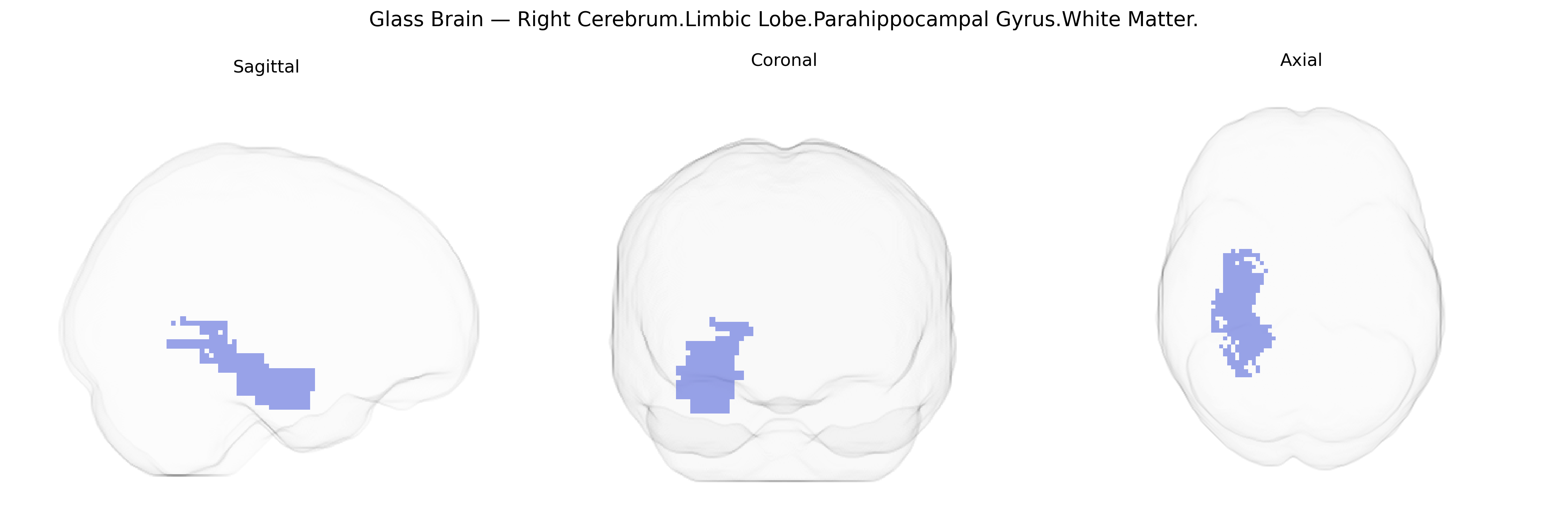 Triplanar Ghost Brain