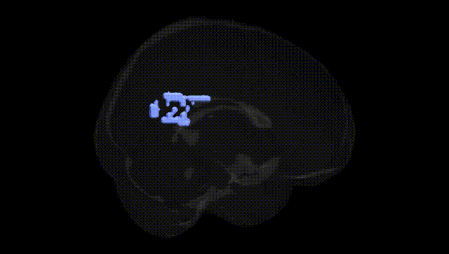 Full Brain Black