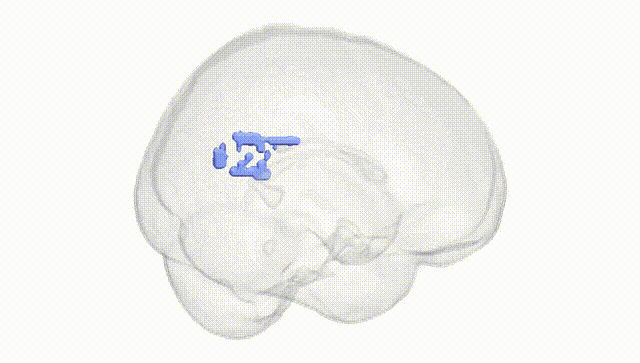 Full Brain White