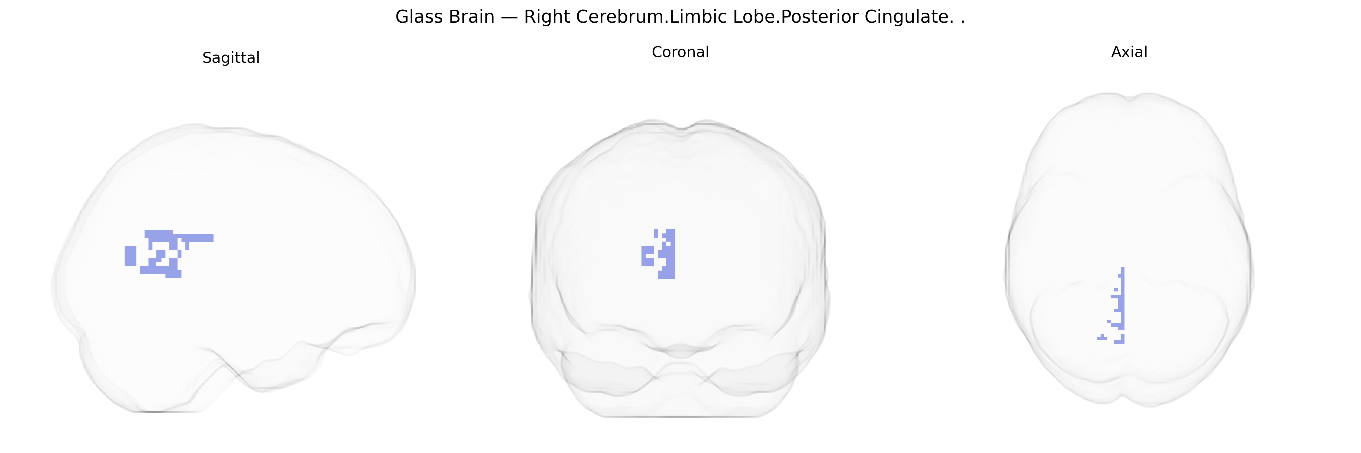 Triplanar Ghost Brain