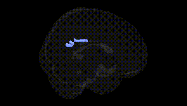 Full Brain Black