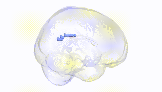 Full Brain White