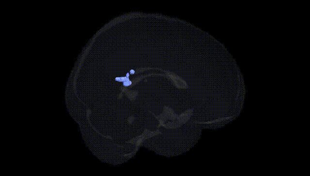 Full Brain Black