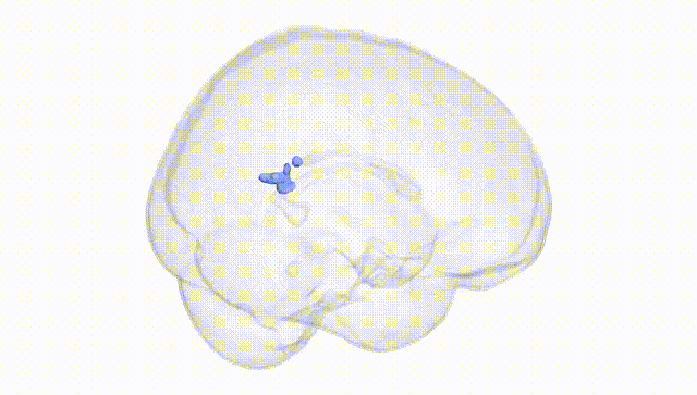 Full Brain White