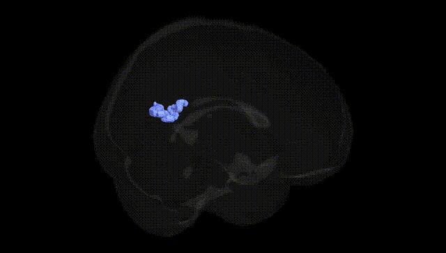 Full Brain Black