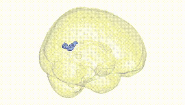 Full Brain White
