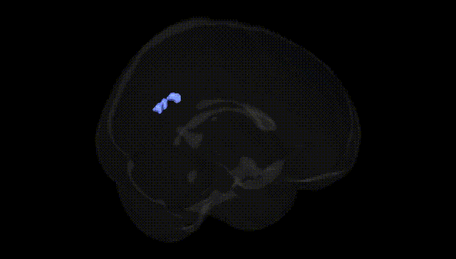 Full Brain Black