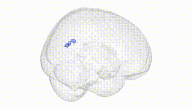 Full Brain White