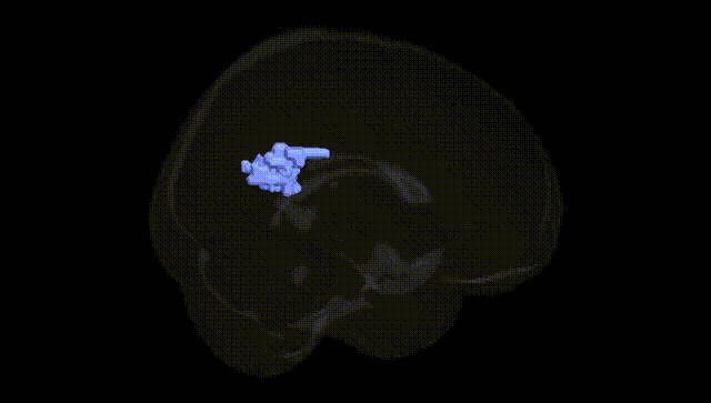 Full Brain Black