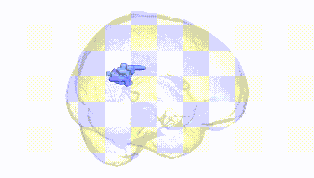 Full Brain White