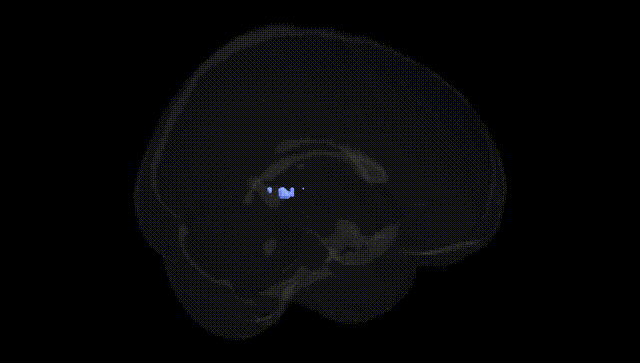 Full Brain Black