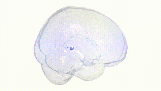 Full Brain White