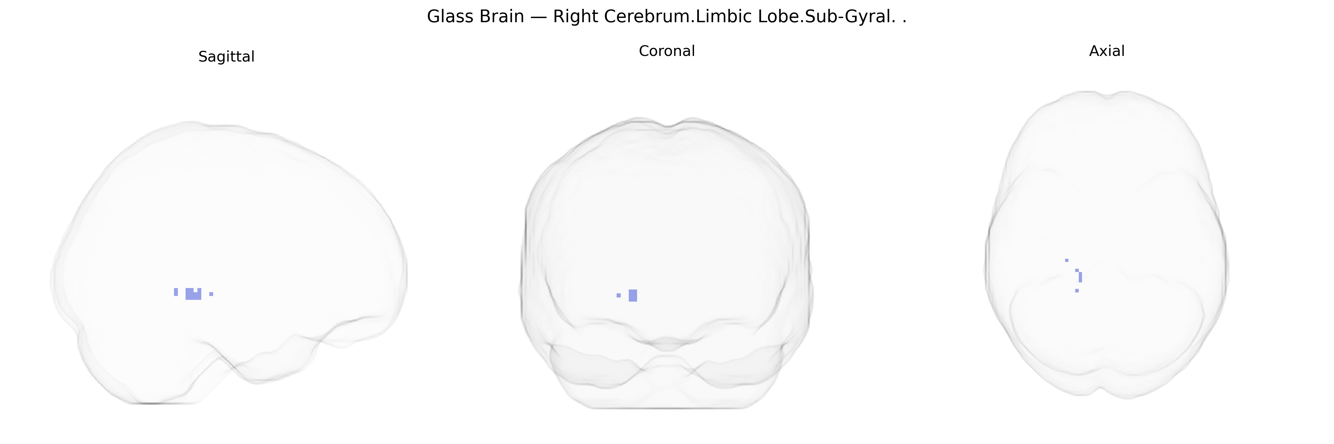 Triplanar Ghost Brain