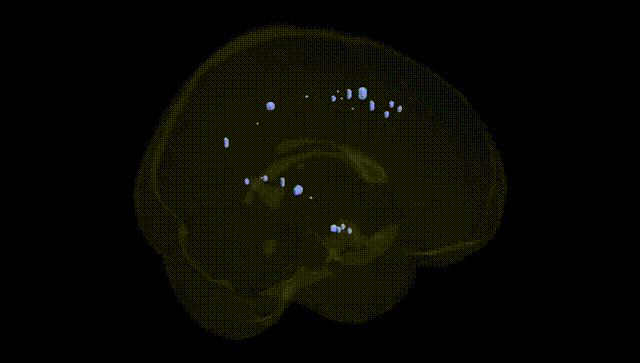 Full Brain Black