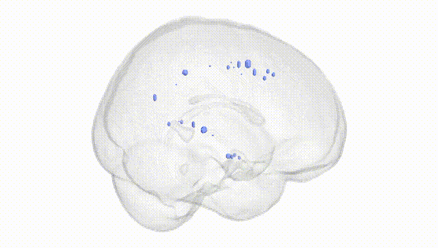 Full Brain White