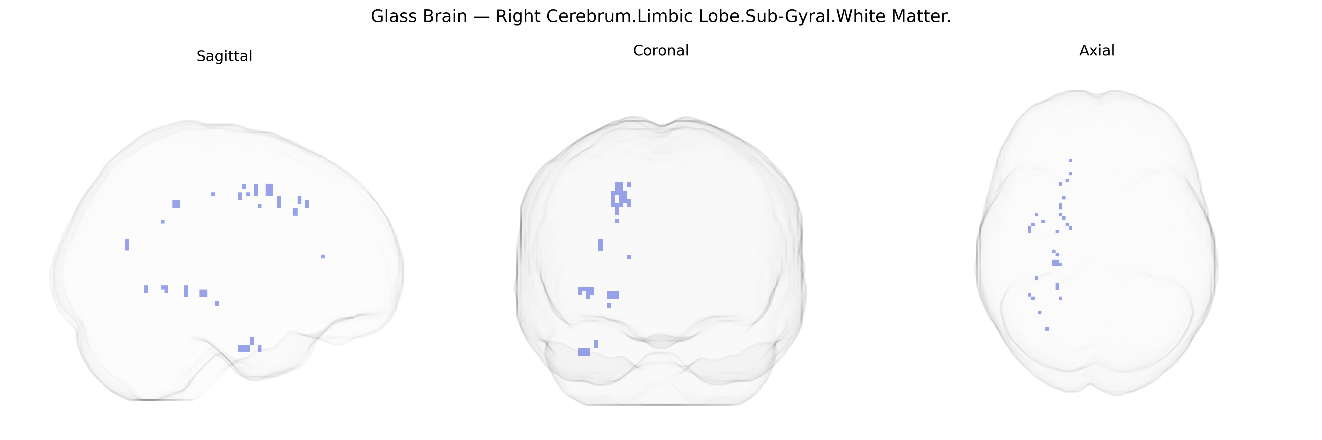 Triplanar Ghost Brain