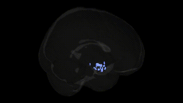 Full Brain Black