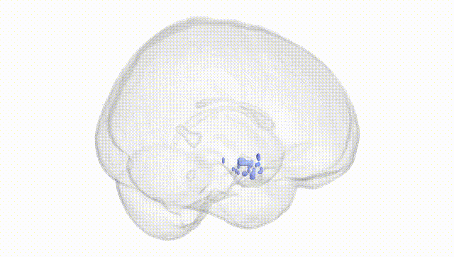 Full Brain White