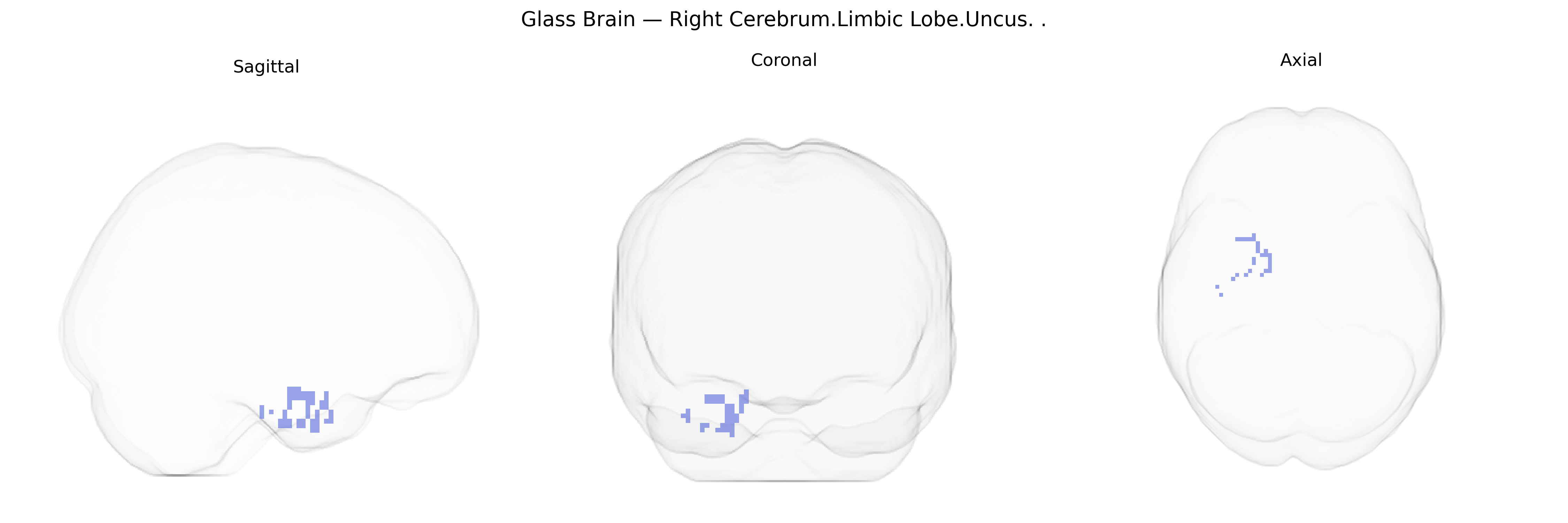 Triplanar Ghost Brain