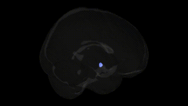 Full Brain Black