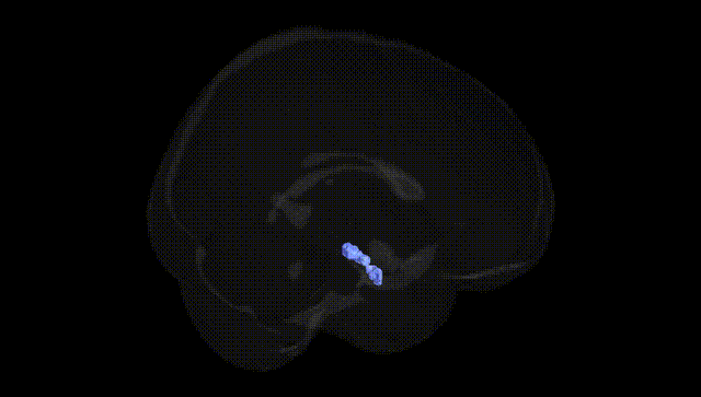Full Brain Black