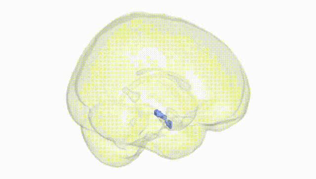 Full Brain White