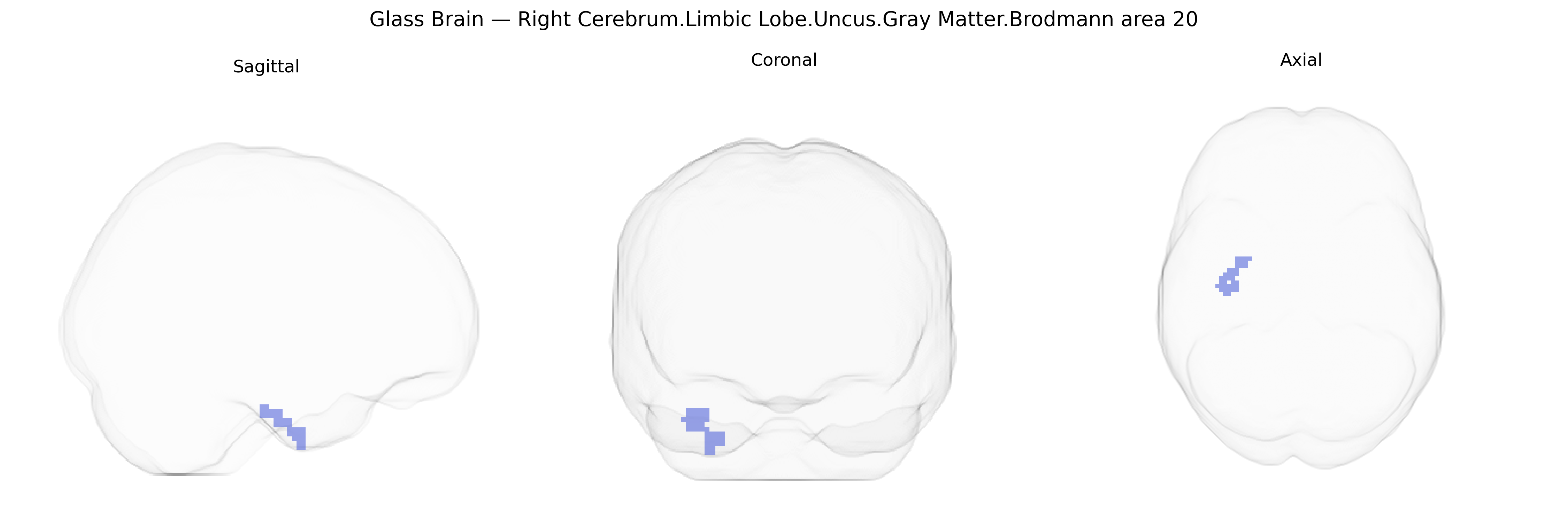 Triplanar Ghost Brain