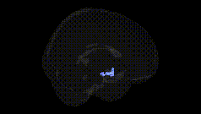 Full Brain Black