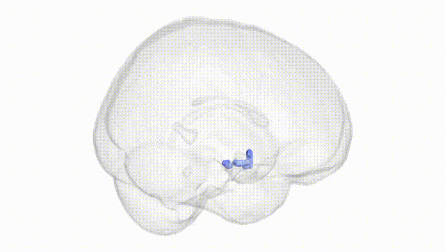 Full Brain White