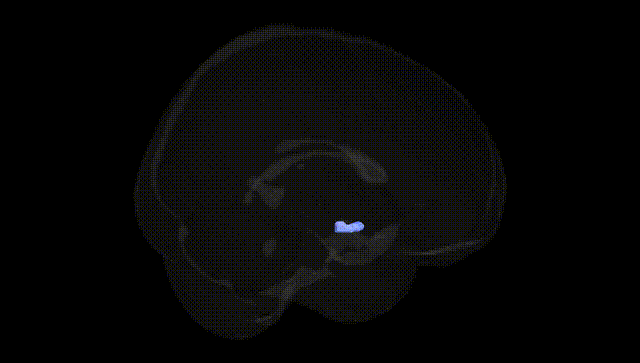 Full Brain Black