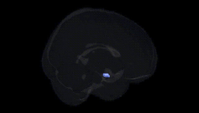 Full Brain Black