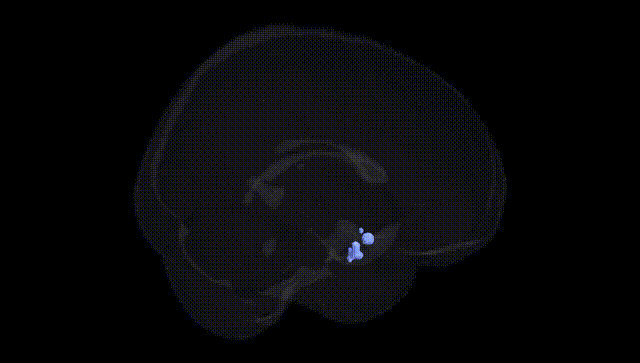 Full Brain Black