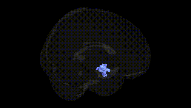 Full Brain Black