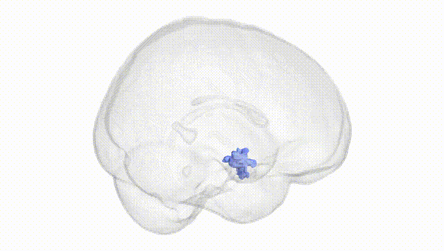 Full Brain White