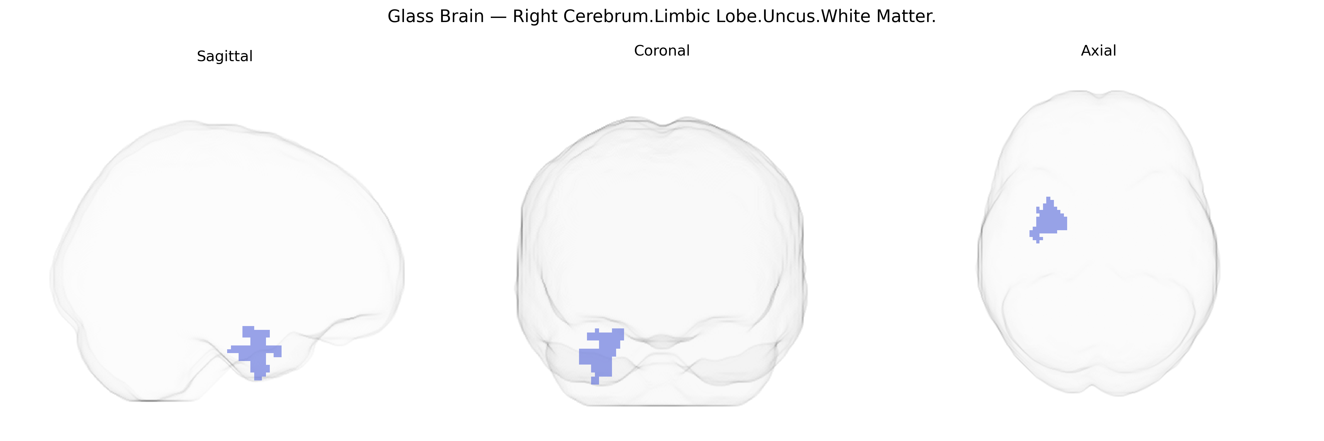 Triplanar Ghost Brain